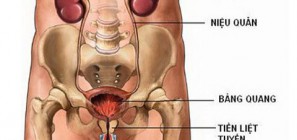 Viêm niệu đạo là gì?