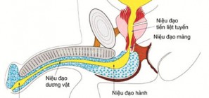 Nguyên nhân triệu chứng bệnh viêm niệu đạo